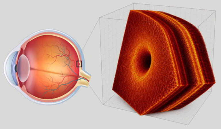 New AI tools could help eye doctors diagnose retinal disease faster