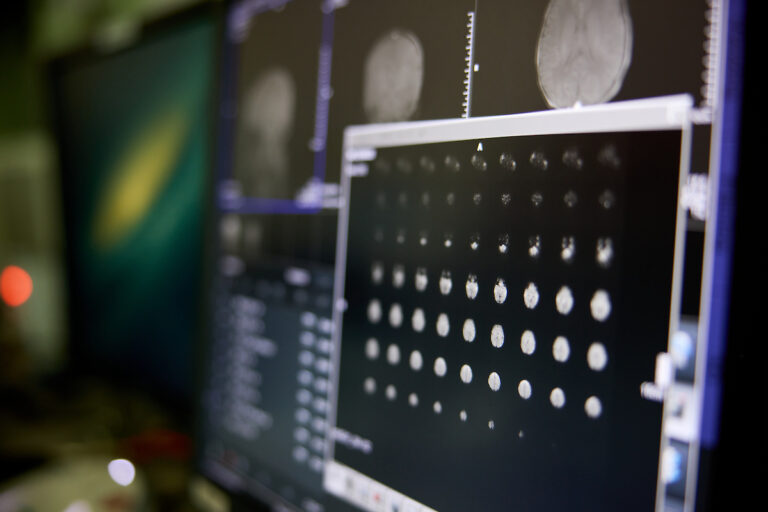 New technique evaluates reliability of AI-enabled medical imaging